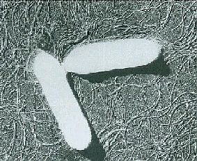 ボツリヌス菌（電子顕微鏡）