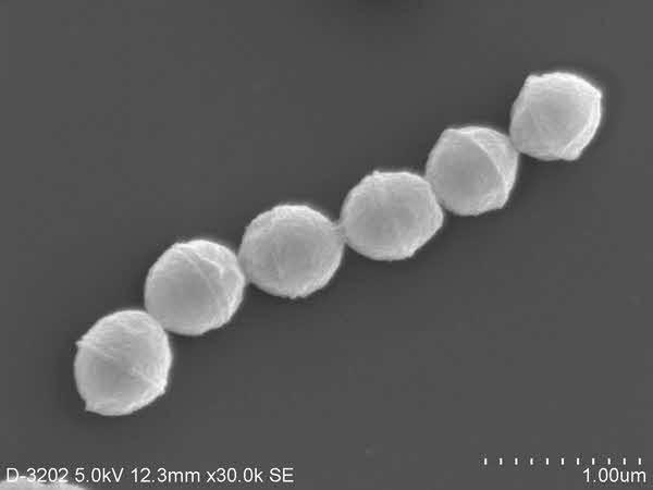 溶血性レンサ球菌（溶連菌）電子顕微鏡写真