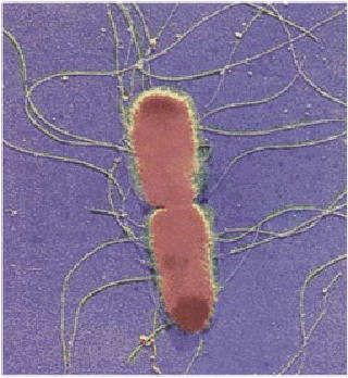腸チフス（顕微鏡写真）食中毒e840net