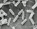 電子顕微鏡写真　-　腸管出血性大腸菌Ｏ１５７食中毒