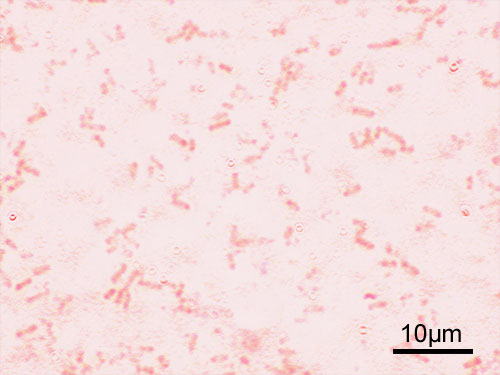 赤痢菌（顕微鏡写真）