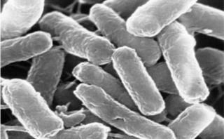 病原性大腸菌の電子顕微鏡写真｜食中毒e840net