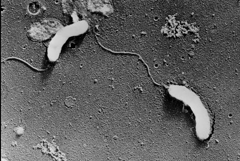 コレラ菌写真2|食中毒.e840net